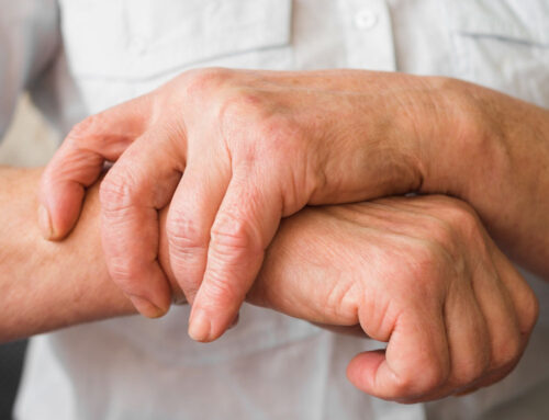 Patient Stories, Thumb Arthritis